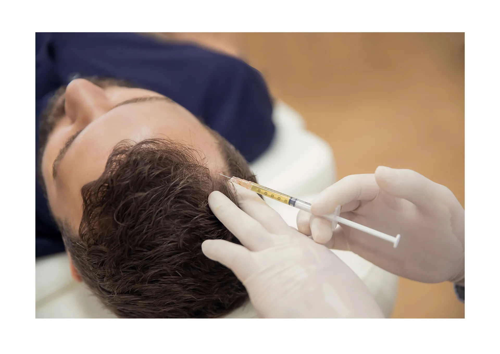 TERAPIA PRZECIW WYPADANIU WŁOSÓW DR CYJ