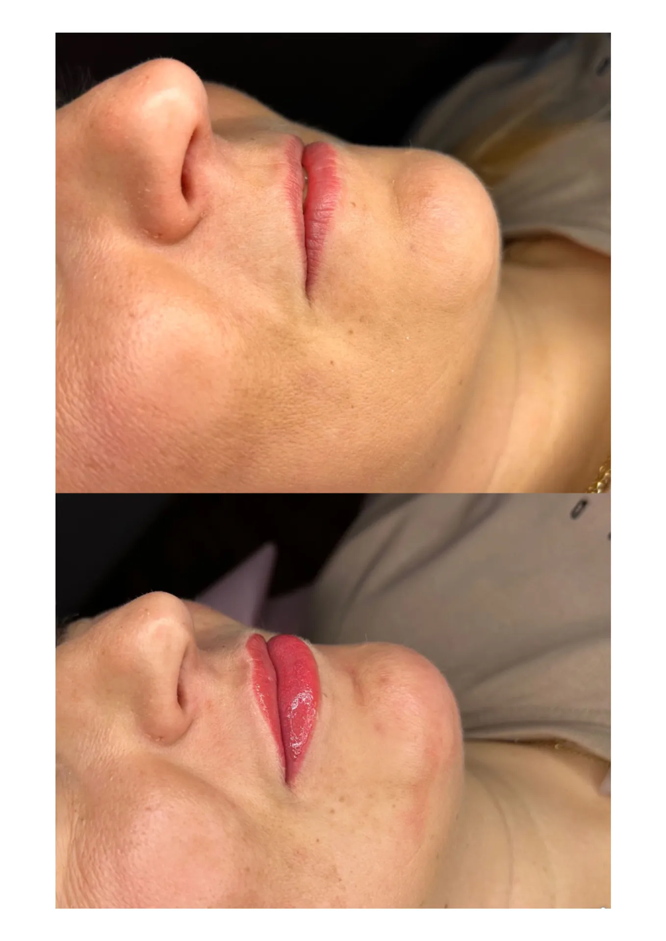 MAKIJAŻ PERMANENTNY UST