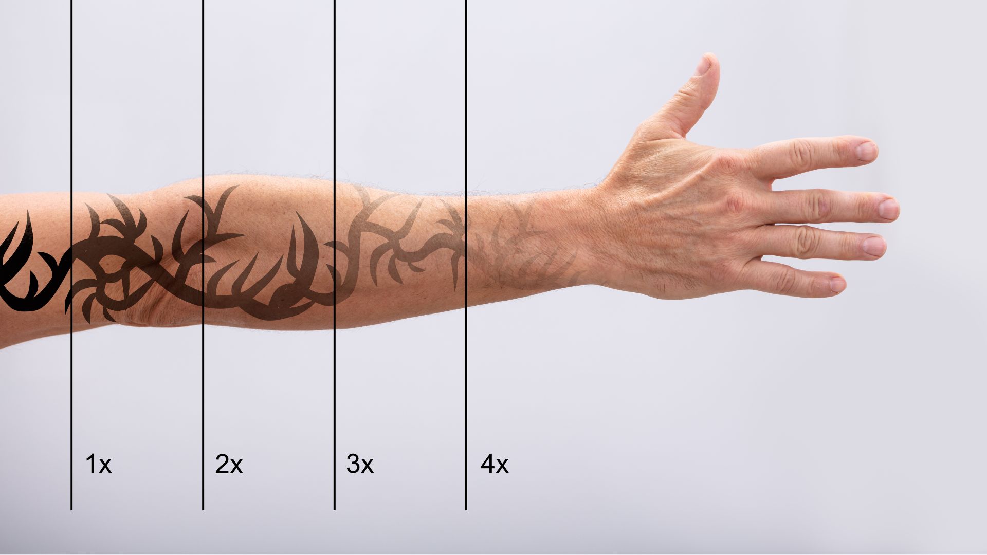 LASEROWE USUWANIE TATUAŻU- MAKIJAŻU PERMANENTNEGO